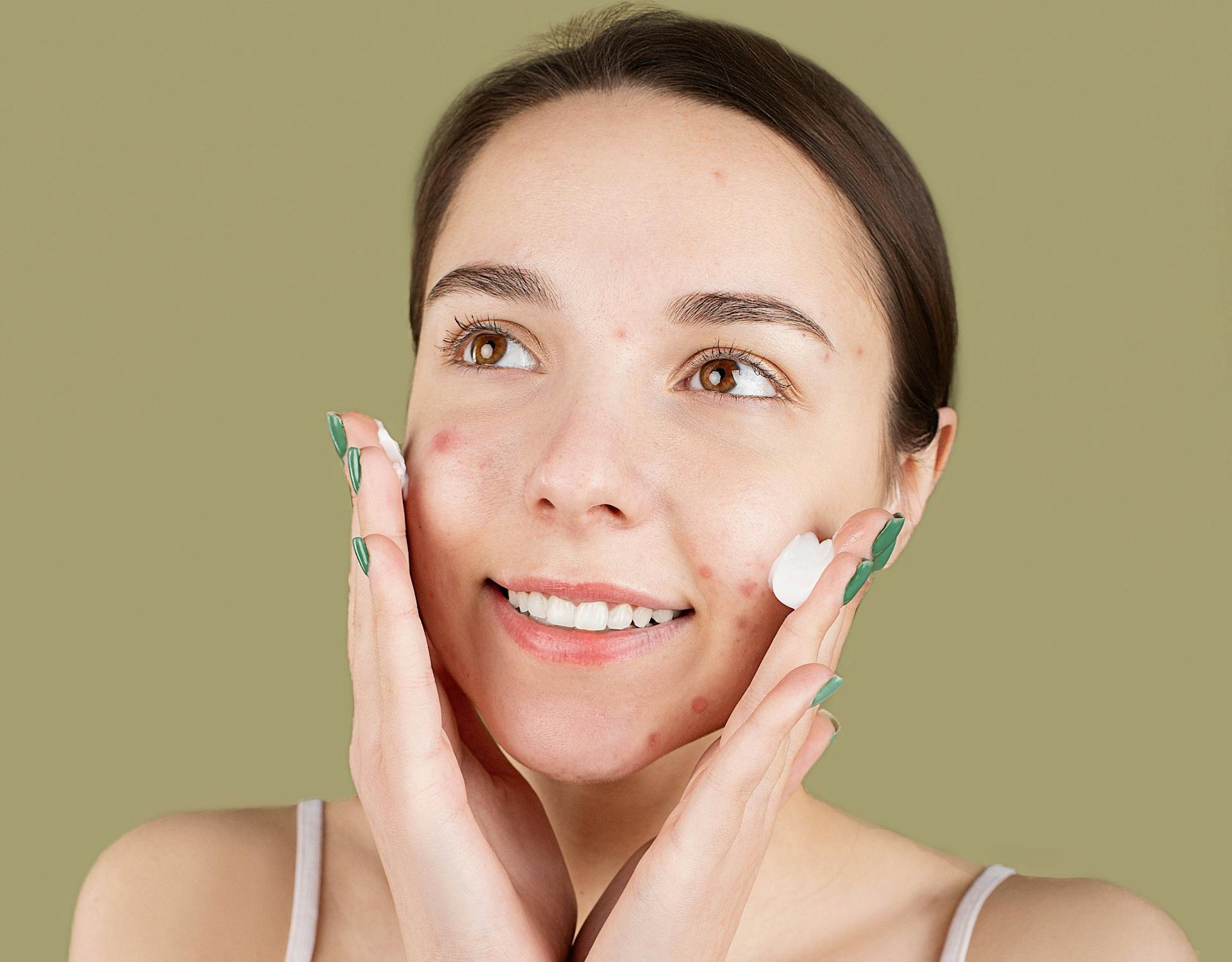 best acne treatment for teens